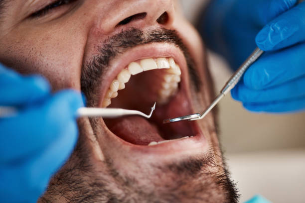 Fast & Reliable Emergency Dental Services in MI