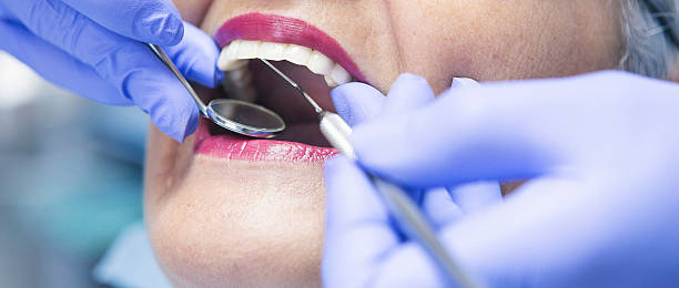 Best Emergency Dental Care for Broken or Chipped Teeth in Grant, MI